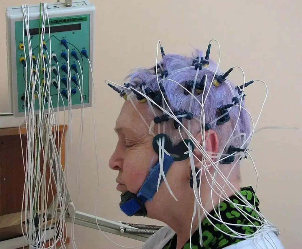 همه چیز درباره دستگاه EEG یا الکتروانسفالوگرام